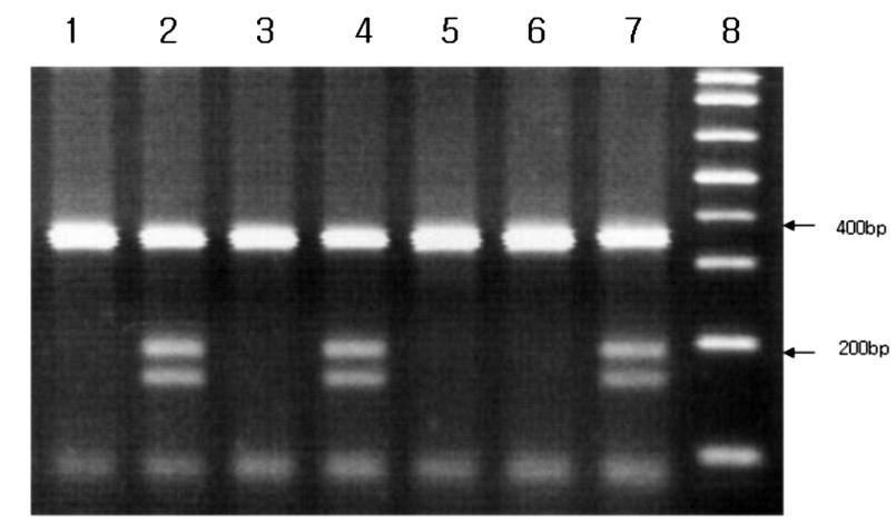 한국인제 2 형당뇨병환자에서 NAD(P)H oxidase p22phox C242T 유전자다형성과대혈관합병증과의연관성 다. 대조군은관상동맥조영술을시행한군에서는 50% 이하의관상동맥협착이있는환자와, 관상동맥조영술을시행하지않은군은관상동맥질환증상과말초혈관질환이없는환자로정의하였다.