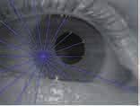 dark pupil 효과를이용한동공검출기법은지금까지많은연구가되어왔으나대부분의방법이에지검출이나영상의이진화와같은휴리스틱한알고리즘에기반한경우가많다. 대표적인예제중하나는 Li et al. 이 2005년에발표한 Starburst 알고리즘이다 [4].