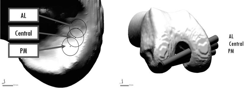 Knee Graft Bending Angle of Posterior Cruciate Ligament: Analysis using an In Vivo 3-D Model Department of Orthopaedics, Hallym University Medical Center, Dongtan 1, Korea University of Education and