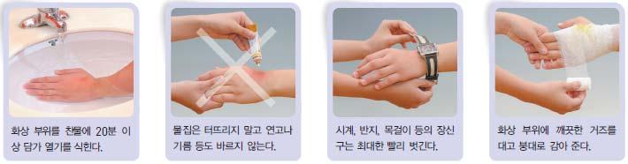 햇빛 ( 일광 ) 화상은 (1도화상과같이 )