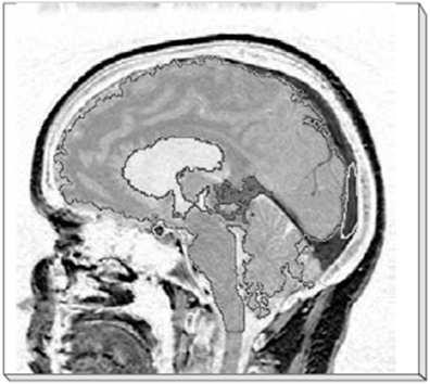 전략제품 현황분석 의료용 영상처리 MRI (Magnetic Resonance Image) - 영상기술 중 하나로 핵자기공명 원리를 사용. 자기장을 발생하는 자기공명 촬영 장치에 인체를 넣 고 고주파를 발생시키면 신체의 수소 원자의 전자가 공명하게 됨.