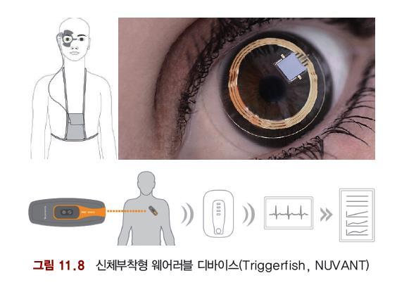 스마트의류, 부착형헬스케어기기등 마스터제목스타일제목편집스타일편집 스마트의류 헬스케어분야와결합 사용자의생체리듬 (vital sign) 이나혈류의변화등을측정