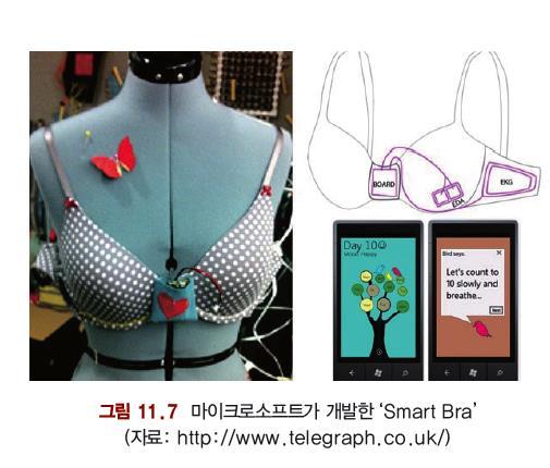 (Attachable Healthcare devices) 스위스벤처기업 Sensimed 녹내장환자의안압을 24 시간측정하는콘택트렌즈형태의스마트의료기기