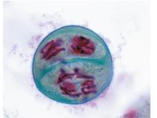 자매염색분체가분리 반수체딸세포형성 두개의반수체세포가형성된다 ; 염색체는여전히복제된상태로있다