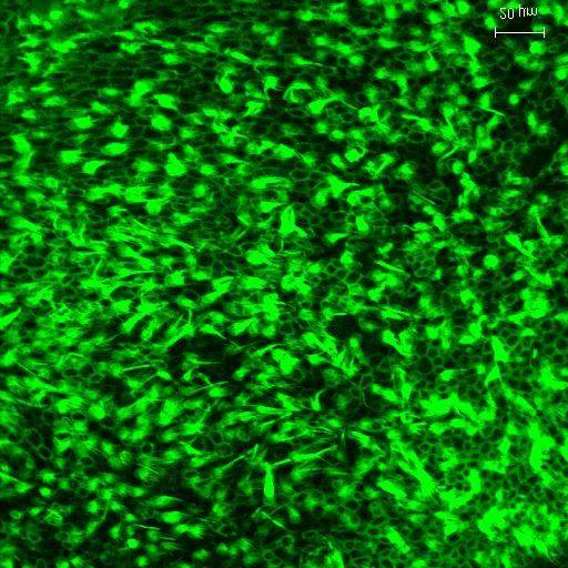 Photomicrographs showing utricular organotypic cultures labeled