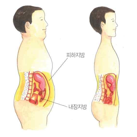 피하지방과내장지방 비만과관련이있는건강문제 2.