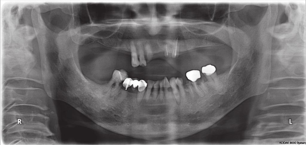Preoperative photograph: radiographic view.