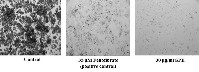 배암차즈기에탄올추출물의항비만효능 405 A B Control 35 μm Fenofibrate 30 μg/ml SPE (positive control) Cont 35 μm SPE Fenofibrate (30 μg/ml) Fig. 2. Effect of SPE (Salvia plebeia R. Br.