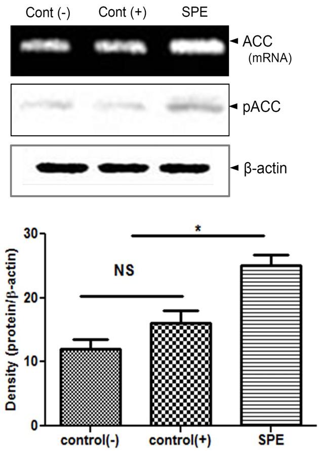 densitometric analyses as compared with