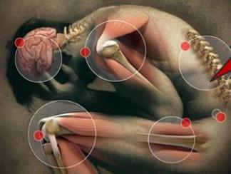 Peripheral Neuropathy, CIPN) 치료제 1) 화학요법유도신경병증성통증치료제의개요 신경병증성통증은신경계의손상이나기능적이상으로발생하는통증으로, 난치성이며만성적으로오래지속되는특성으로인하여이러한통증으로고생하는환자는삶의질이현저히저하되어통증자체뿐만아니라수면장애, 우울증과같은정서장애,