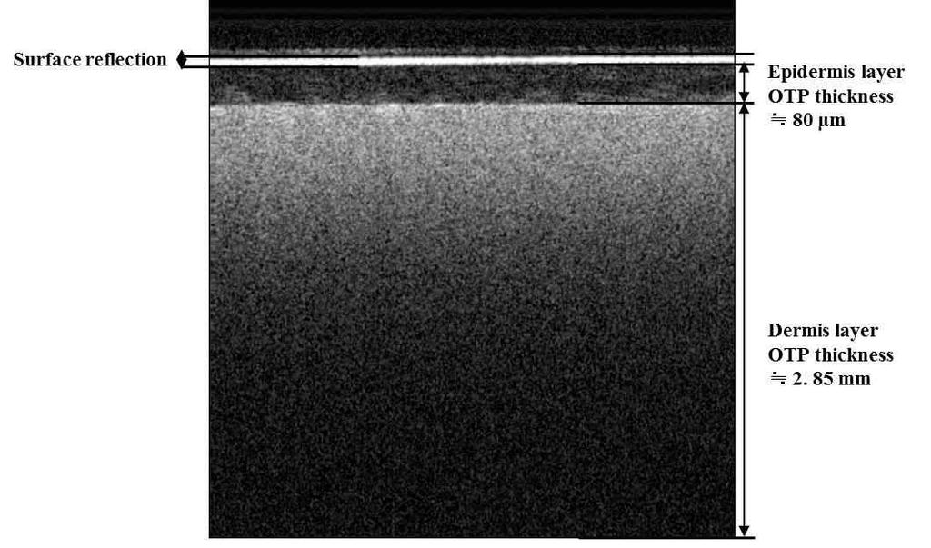 3.3.5 광간섭단층영상기를이용한다층 TSOTP 구조분석 그림 15. 광간섭단층영상기를이용한다층 TSOTP 의단면측정영상 그림 15는광간섭단층영상기 (Optical Coherence Tomography, OCT) 를이용하여진피층팬텀 ( 전체혼합용액의 1.0% 이산화티타늄첨가 ) 위에표피층팬텀 ( 전체혼합용액의 1.
