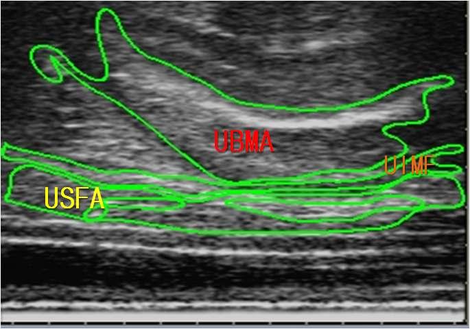 3. 연구결과및고찰 ( 그림 ) 초음파기계로측정한 4-5번째늑골부위이미지 UBMA : 갈비부위근육면적, UIMF : 근간지방면적, USFA : 피하지방면적 ( 그림