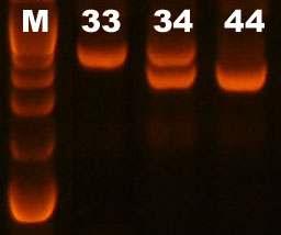 MgCl2)2ul Taq polymerase 0.5ul 에총반응액 20ul로하여 PCR system 9700(ABI 사) 을사용하였다.