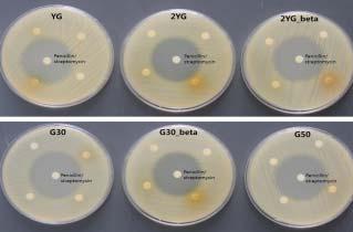 나 ) 실험결과 1 항박테리아활성평가 YG series 3종과 G series 3종의항박테리아활성을평가한결과모든시험약물에서상기도감염을유발하는 S. aureus에대한항균활성은나타나지않았음 Antibacterial activity of YG, G_ series 2 항바이러스활성평가 YG series 3종과 G series 3종의항바이러스활성을평가하였음.