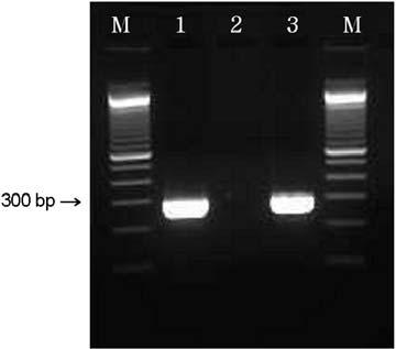 Multiplex PCR to distinguish an intact selc locus from one disrupted by LEE.
