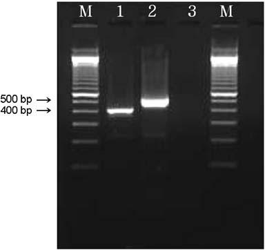 espp 유전자 PCR 결과설사및식중독환자유래 STEC에서 26주 (62%), 무증상집단감염 STEC에서 6주 (50.1%) (p = 0.339), 소분변유래 STEC에서 3주 (18%) 가확인되었고, 식품분리주중 1건 (50%) 에서확인되었다 (Fig. 6). Figure 6. PCR analysis of the espp (301 bp)genes.