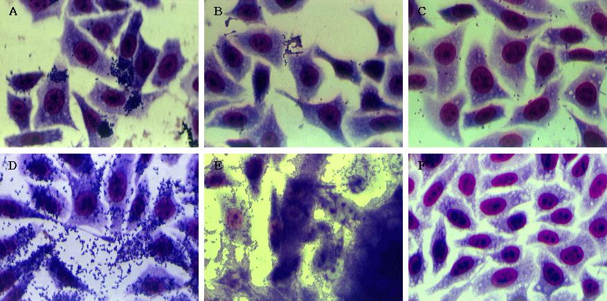 Molecular Genetic Characterization of Shiga Toxin-producing E. coli 89 A B C D E F Figure 8. Adherence patterns of STEC in HEp-2 cell culture.