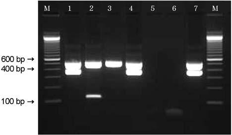 84 MJ Kim, et al. Figure 2. Distribution of the STEC genotype by multiplex PCR.
