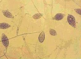 역병 (Phytophthora fruit rot) 가. 병징잎, 엽병, 줄기및과실등에발병한다. 잎의경우에는많은강우후뜨거운열을받은것처럼대형의병반을형성하고맑게개여건조하면하얀색의병반을형성한다.