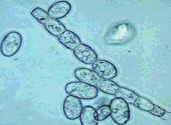 병원균 : Sphaerotheca fuliginea Pollacci. 진균계의자낭균에속하는순활물기생균으로인공배양이되지않으며, 분생포자와자낭포자를형성한다. 병원균은비교적고온에서번식하며, 유황에대해선매우약하다. 다.