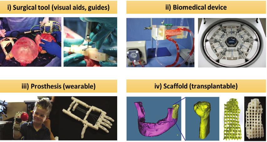 한국정밀공학회지 제 31 권 12 호 pp. 1067-1076 December 2014 / 1068 (a) 3D visual aid based on MRI5 (b) Surgical guide2 Fig. 2 Use of 3D printed objects for surgical simulation and guide instrument Fig.