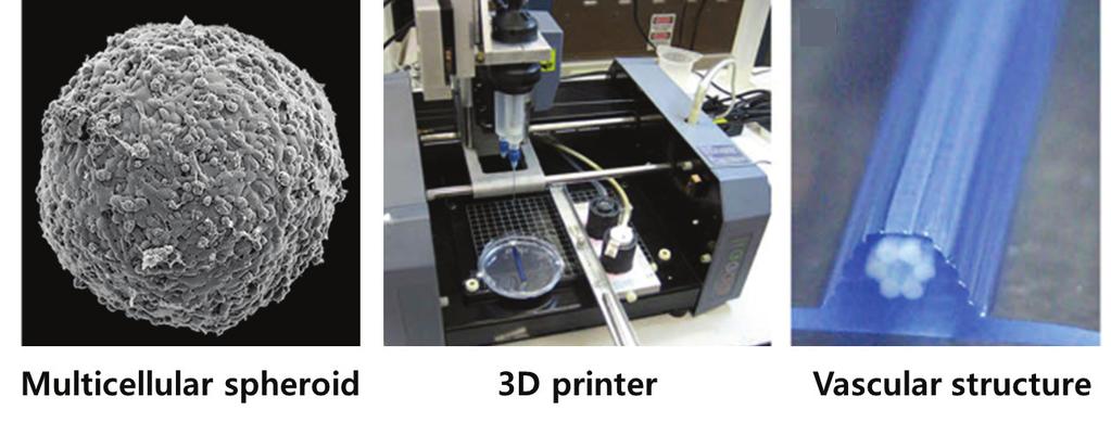 16 3D printing system of cell-hydrogel and electronic materials and 3D printed bionic ears35 하는 방식 이외에 Norotte 등은 Fig.