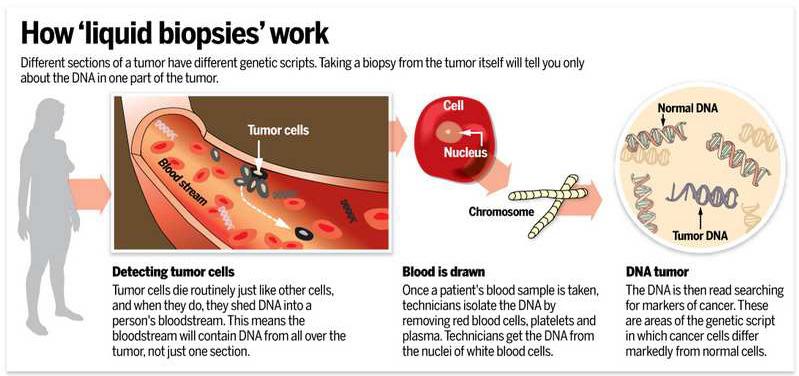 Technology Industry Policy > 03 2017년세계경제포럼선정 10대유망기술 1 액체생체검사 Liquid Biopsies 비침습적 (non-invasive) 액체생체검사법은혈액이나오줌의체액검사만으로신체부위별체액내에서돌아다니는암세포유래 DNA 조각들을분석함으로써암발생, 전이등을상세히진단기존의조직샘플채취,