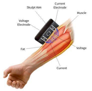 근육운동을할때얼마나운동효과가있는지를바로알수있는근육량측정기간편한근육량측정기도등장하고있는데, Skulpt는팔, 다리등측정하고자하는근육부위에기기를대면전류가흘러서해당부위의지방및근육의정도를파악해줌으로써운동을꾸준히해나가는데에동기부여를해주고, 성취감을느낄수있도록도와준다.