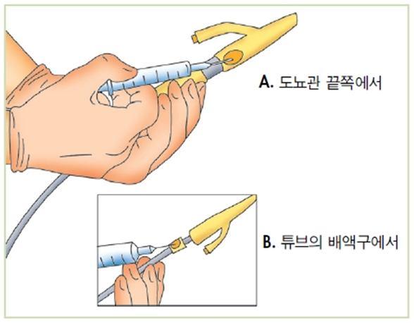 3) 멸균검사물채취 (1) 단순도뇨 ❶ 목적 - 무균적인소변검사물을수집하기위함 ❷ 필요장비및물품 - 단순도뇨세트 ( 소독솜, 겸자또는지혈감자 ), 단순도뇨관 ( 성인 : 7~9 Fr. 소아 : 4 Fr.