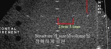 Axial and lateral resolution Sensitivity Gray scale &