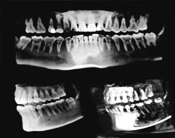 연조직등을방사선을이용하여영상화하는장치, 구강내 X-ray, 구강외 X-ray, Cone Beam