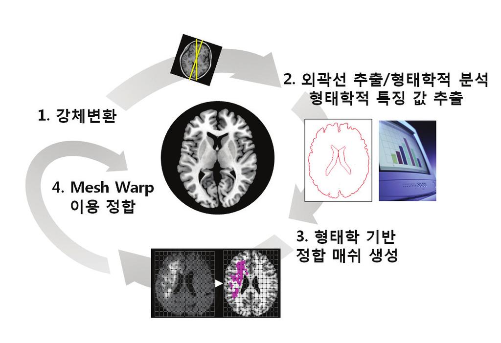 2 뇌졸중 MRI 의이해와정량분석 : 매트랩을이용한참조표준 / 뇌지도제작 2. 1. 4. 3.