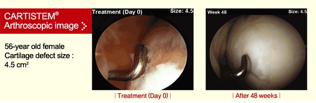 The Clinical Trials Before 3 Months