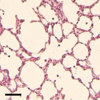 Pneumostem Before