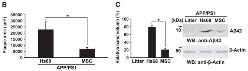 Parenchymal Delivery of Neurostem to Target