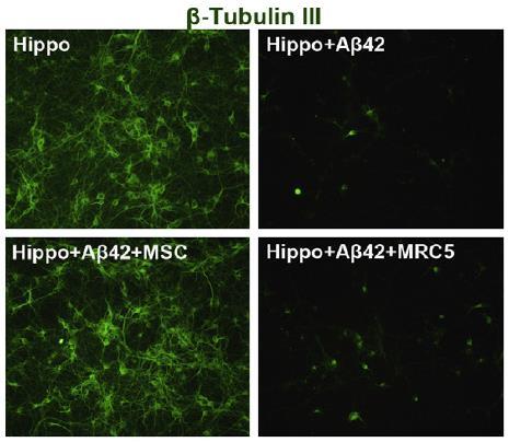 FEBS Letters Soluble intracellular adhesion molecule-1