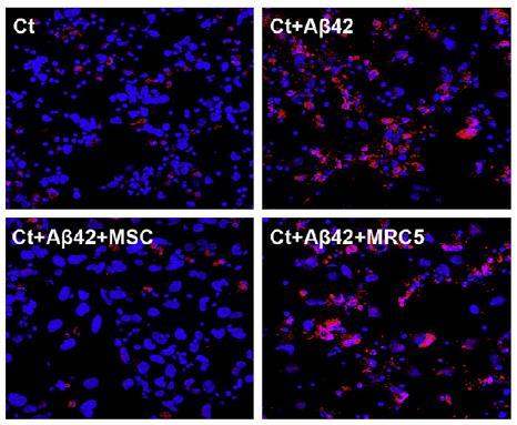 stem cell reduces amyloid-b plaques Medipost, Cell Death and