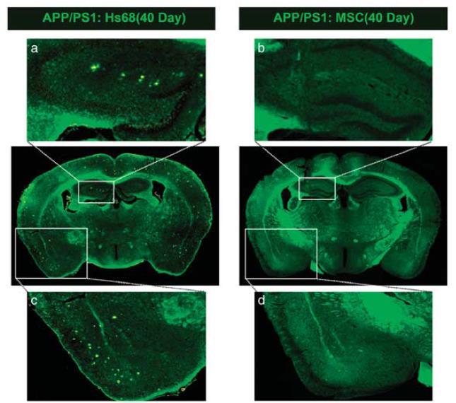 FEBS Letters Soluble intracellular adhesion molecule-1 secreted by human umbilical cord blood-derived mesenchymal stem cell reduces