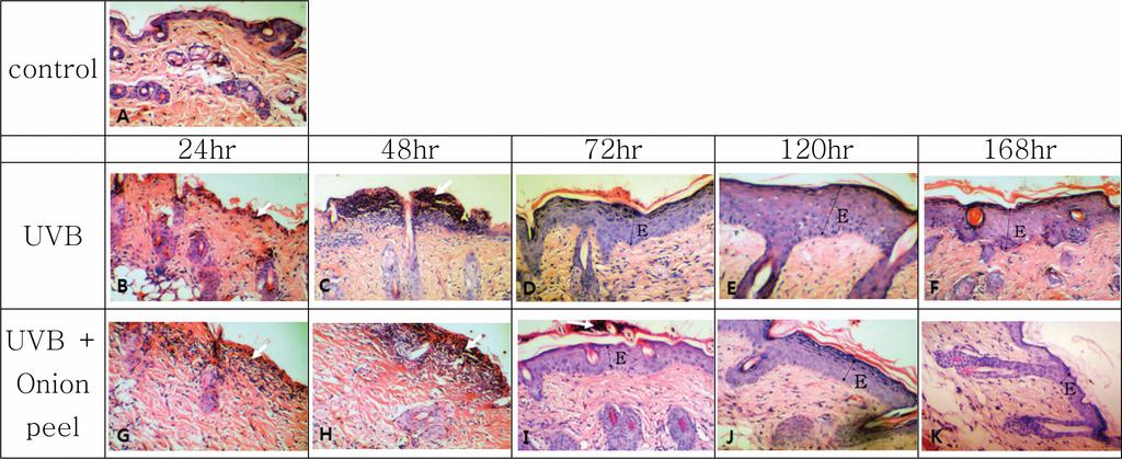 394 Kor. J. Pharmacogn. 라닌 양이 증가하였으나 UVB 조사군에 비해서는 모든 시 간군에서 감소하였고, 72시간군에서는 유의적으로 감소하였 다(Table II).