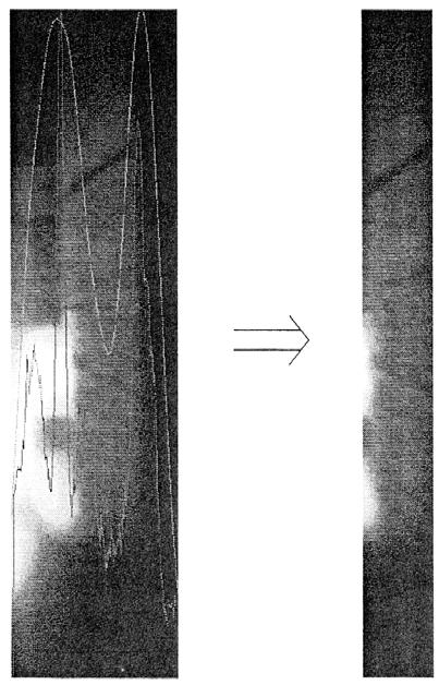 나. 망막이미지영역추출 세극등의이미지는가는형상을하고있으며, PC 카메라의최대이미지는 1280 x 1024 이므로관찰영역을확대하려면카메라를 90도회전시켜설치해야한다. 따라서, 회전된이미지를제대로보기위한회전알고리즘이필요하다. 또한이렇게획득한망막이미지에는필요없는이미지영역도같이얻어진다.