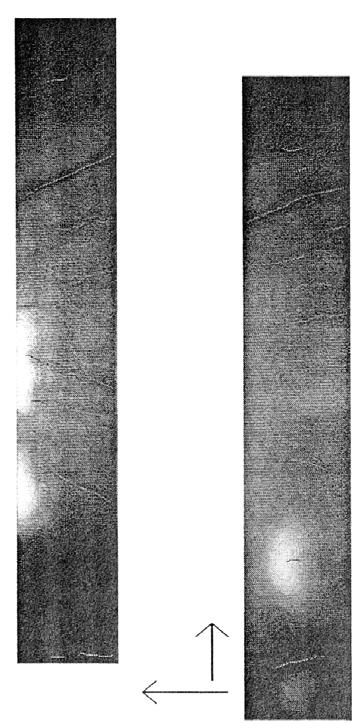 다. 매칭알고리즘 혈관의중심을나타내는에지는기울기정보를갖도록설정을한다. 이는점매칭의단순함 ( 그위치에일치하는점이있는가 ) 을피한다.