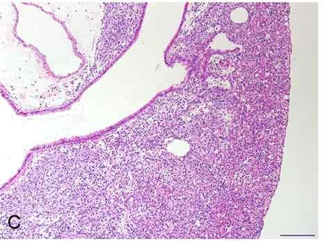 폐부종은 7일째증상이가장크게나타났으며, 기관지폐포세정액 (bronchoalveolar lavage fluid) 에서폐염증세포의증가와관련이있는 interleukin-6 (IL-6), monocyte chemotactic protein-1