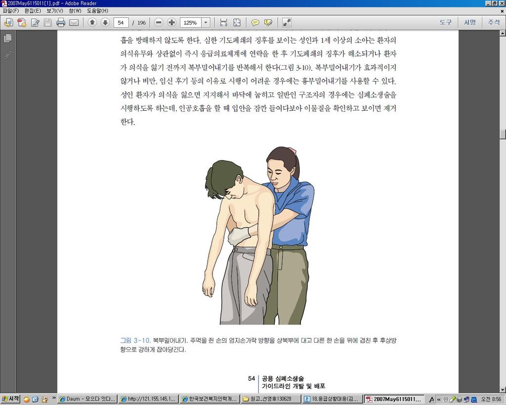 복부밀어내기방법 - 의식이있는경우 : 대상자의몸뒤에서서대상자의명치끝에주먹을