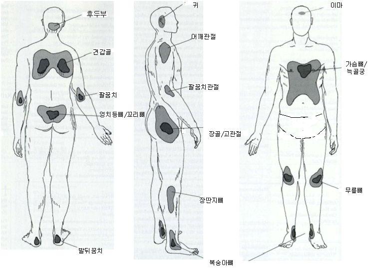 단계와같은치료를한다. 이단계가되면환자의전체적인건강상 태가매우나빠지기쉽다.