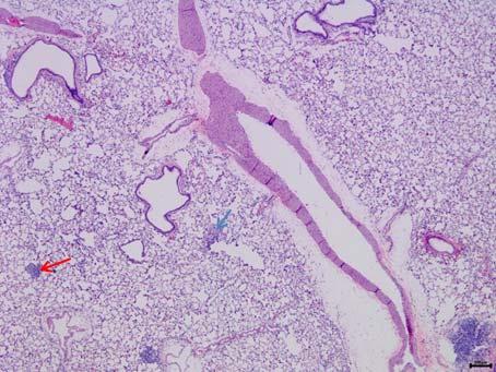 macrophage aggregates), 기관지상피변성 / 재생 (degeneration/regeneration, bronchiolar epithelium) 및삼출물 (exudate) 이관찰되었다. 또한암컷고농도노출군에서폐기종 (alveolar emphysema) 및충 / 출혈 (congestion/hemorrhage) 이관찰되었다.