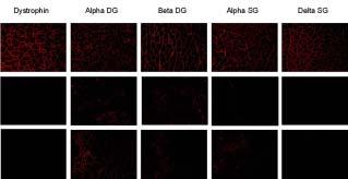 오지영강희진김희진이정화최경규박기덕 Figure 6. Immunofluorescence staining of dystrophin-dystroglycan complex in wild type (upper pannel), control mdx (middle pannel), and L-carnitine treated mdx (lower pannel) mice.