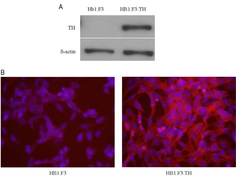 인간신경줄기세포 HB1.F3 에서 alpha-synuclein 과 synphilin-1 유전자전이를통한봉입체형성과세포자멸사 Figure 1. Expression of tyrosine hydroxylase (TH)