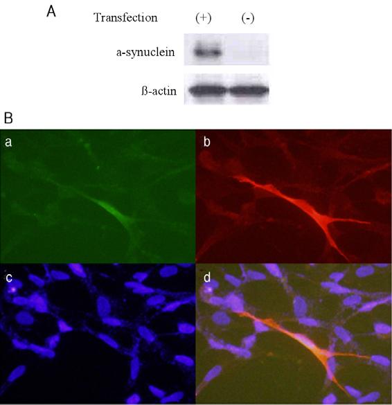 천상명이광김재우김승업 Figure 2. Epxression of a-synuclein and synphilin-1 in HB1.F3 following gene transfection of a-synuclein and synphilin-1.