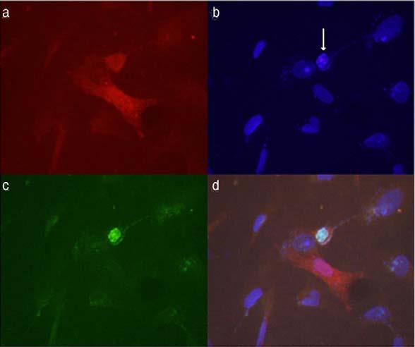 인간신경줄기세포 HB1.F3 에서 alpha-synuclein 과 synphilin-1 유전자전이를통한봉입체형성과세포자멸사 Figure 3. Apoptotic cell death in HB1.F3.TH-BH 4 as shown by DAPI staining and TUNNEL assay following gene transfection of a-synuclein and synphilin-1.