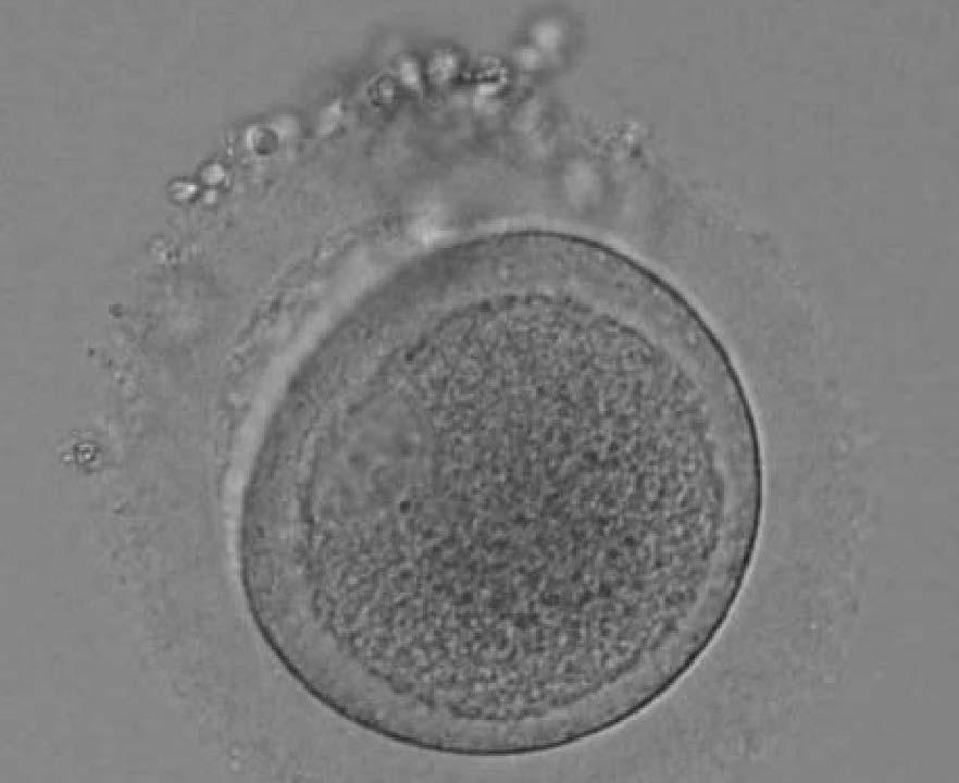 A) 4 cell embryo B) 8